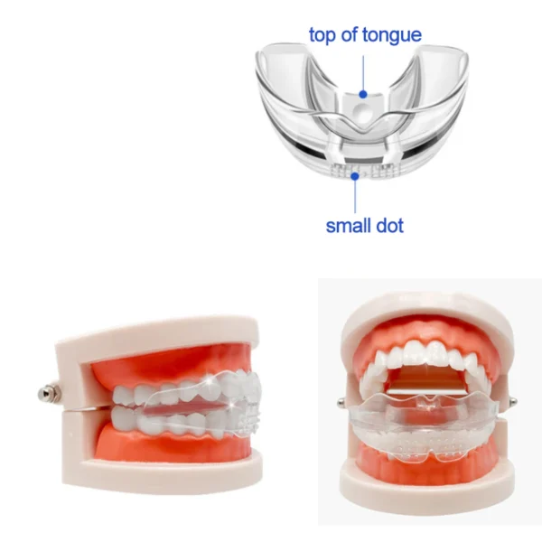 Pack 3 gouttières dentaires - Image 4